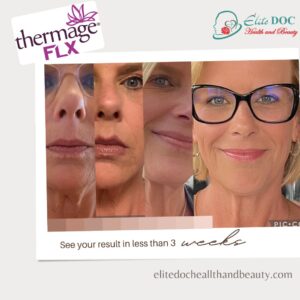 before after thermage flx laser treatment Sugar Land TX