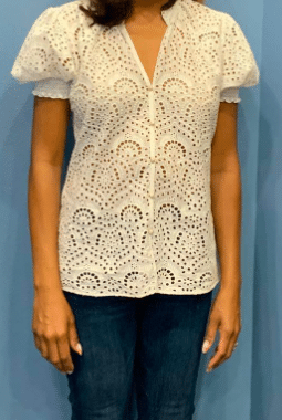 After Image: Semaglutide Weight Loss program - front