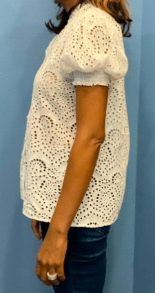 After Image: Semaglutide Weight Loss program - front