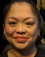 After Image: Juvederm Ultra Plus Lip Enhancement