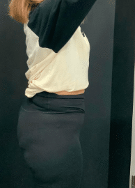After Image: Semaglutide Weight Loss Program - front