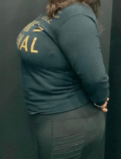 Before Image: Semaglutide weight loss 2 months - front