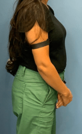 Before Image: Semaglutide Weight Loss Program 3 months - right-side