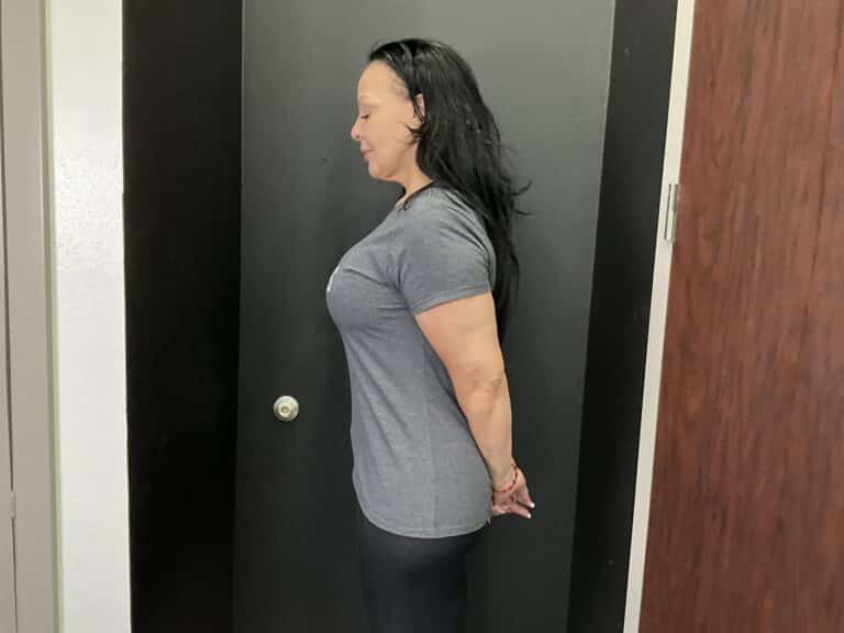 Before Image: Weight Loss Program - front